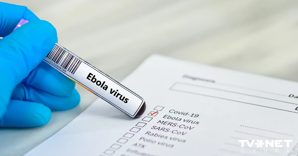 Kongo DR izraisījies Ebolas vīrusa uzliesmojums