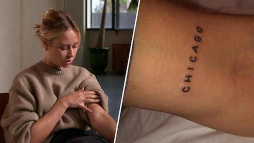 Tattoo gezet op jonge leeftijd leidt vaker tot ontevredenheid, maar laseren 'is duur'