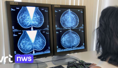 KU Leuven ontdekt hoe 'slapende' borstkankercellen chemotherapie kunnen ontwijken