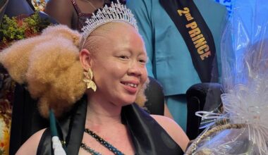 Mensen met albinisme strijden voor zichtbaarheid in Afrika