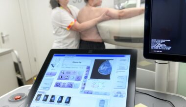 Invoering kunstmatige intelligentie bij borstkankeronderzoek duurt nog zeker drie jaar