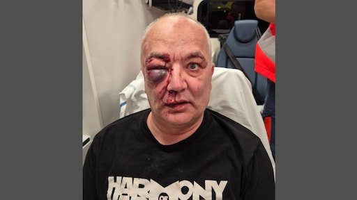 Ggz-medewerker Jan aangevallen door patiënt: 'Was een slachtpartij'