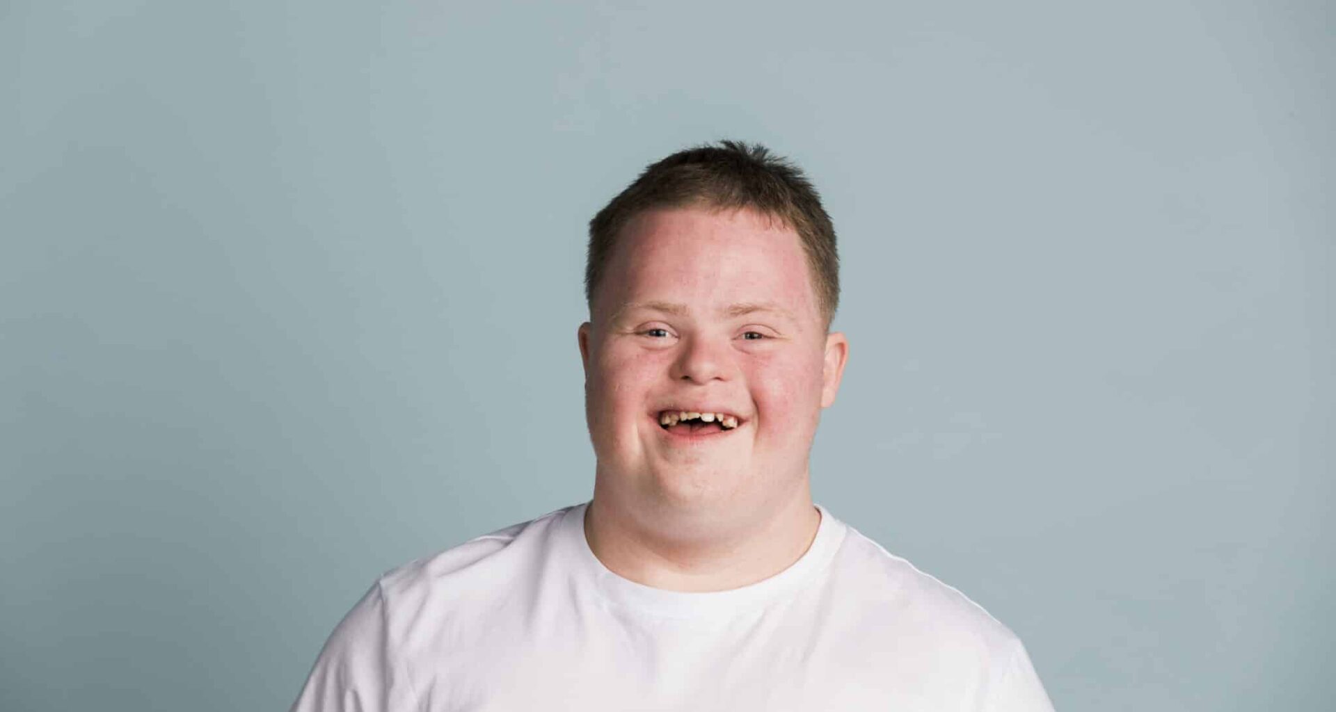 Dit molecuul kan de hersenen van mensen met het Syndroom van Down ook op latere leeftijd nog herstellen