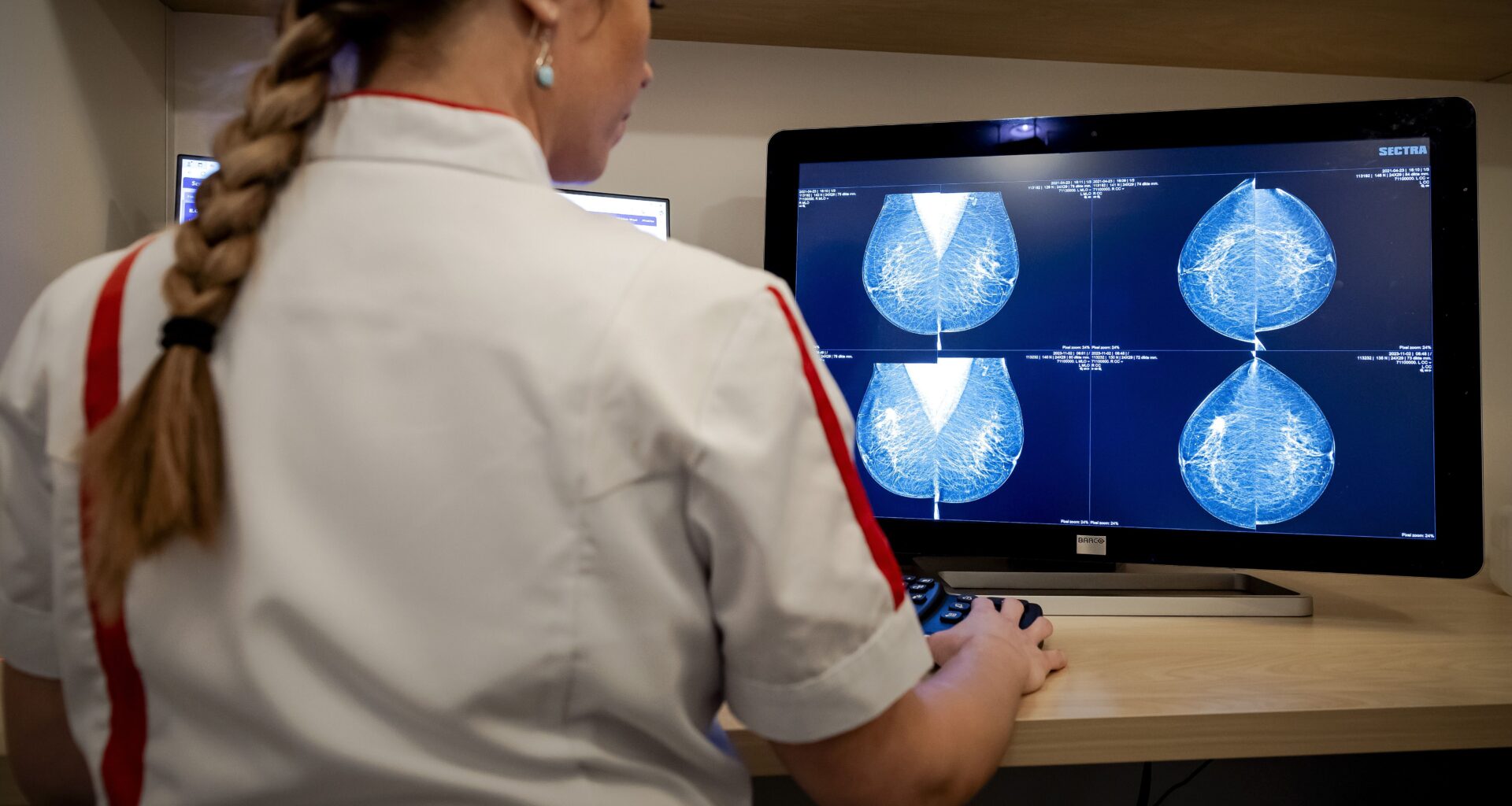 'Paniek om stijging kanker onder vijftigers niet terecht'