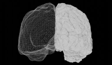 Wat doet een afgesneden hersenhelft? Italiaanse studie vindt een verrassend antwoord