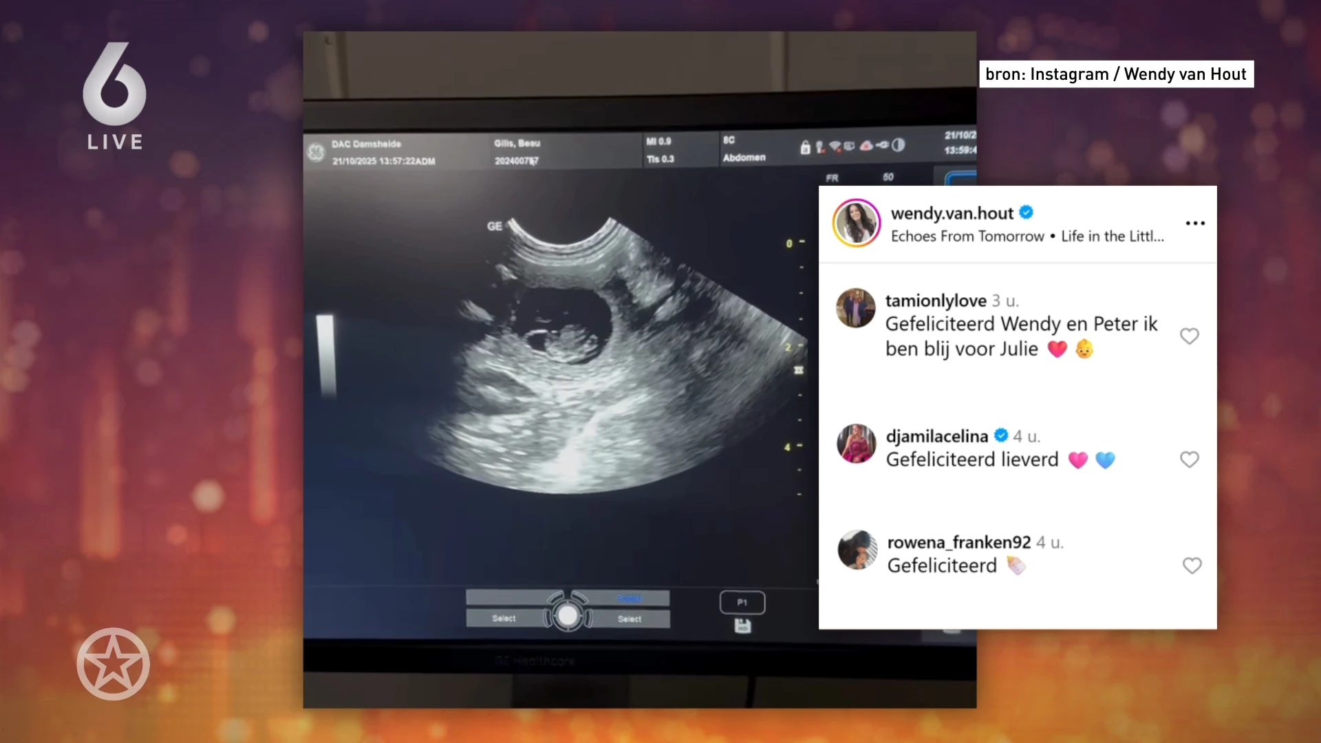 Vriendin Peter Gillis verwart volgers met gezinsuitbreiding
