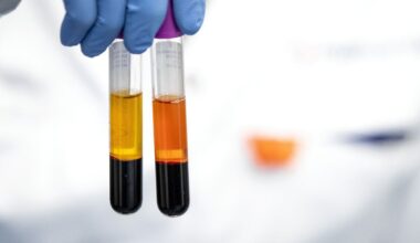 Medicijn dat genen knipt kan hoog cholesterol te lijf