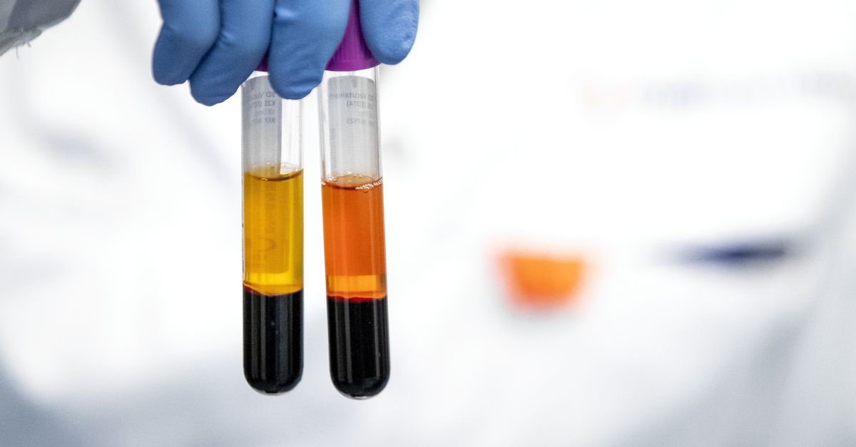 Medicijn dat genen knipt kan hoog cholesterol te lijf