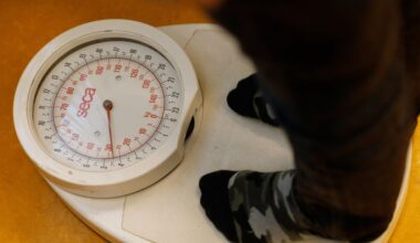 Universiteit Maastricht verwijdert foutief nieuwsbericht over maatschappelijke kosten obesitas