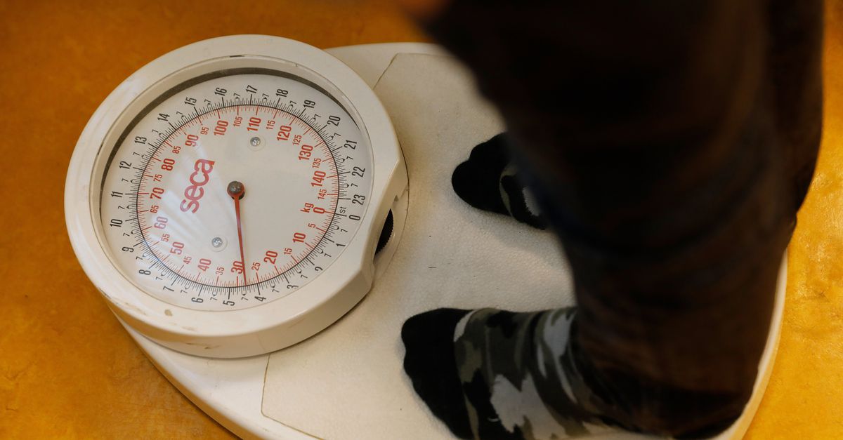 Universiteit Maastricht verwijdert foutief nieuwsbericht over maatschappelijke kosten obesitas