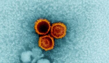 Nieuw puzzelstukje in onderzoek naar verband tussen virusinfecties en auto-immuunziektes