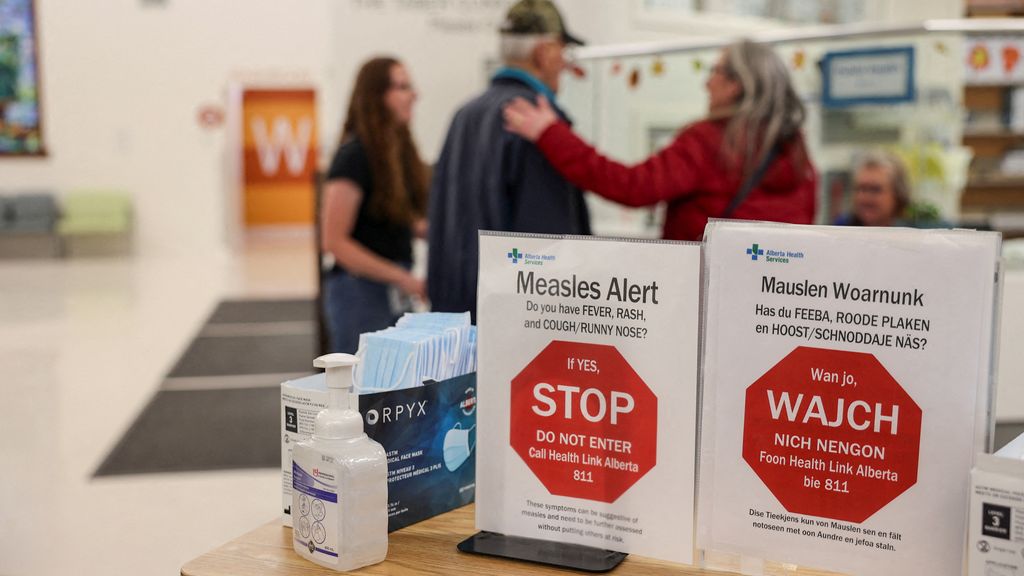 Mazelen zijn helemaal terug in Canada door dalende vaccinatiegraad