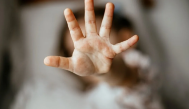 Pleegkinderen geslagen en gebeten door hond in gezinshuis, zelfde stichting drama Vlaardingen