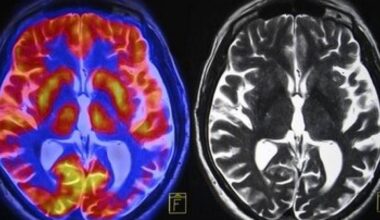 Welingelichte Kringen - Nieuws van overal: minder lezen, meer weten