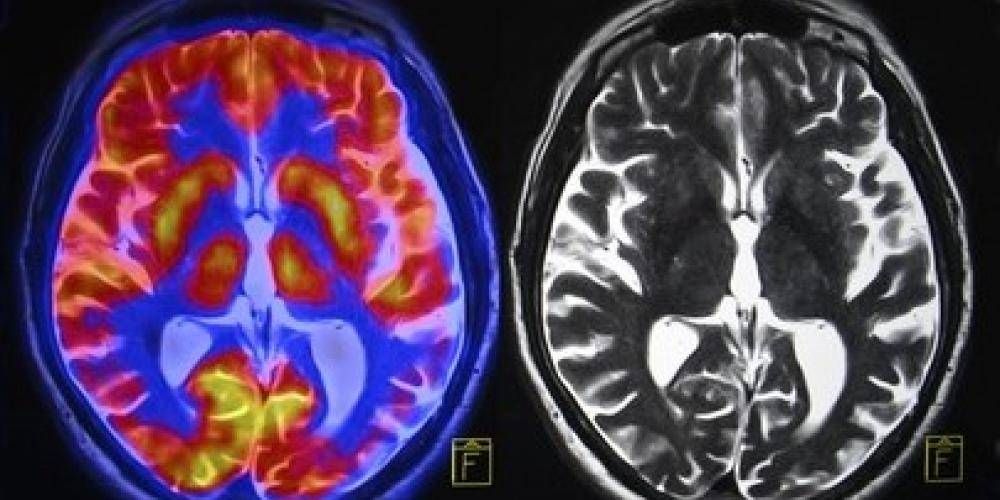 Welingelichte Kringen - Nieuws van overal: minder lezen, meer weten