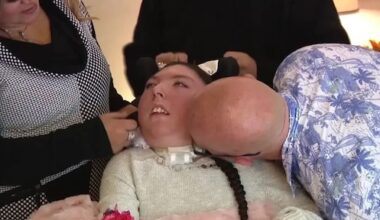 Vrouw zonder hersenen die maar 4 jaar zou worden, viert 20ste verjaardag