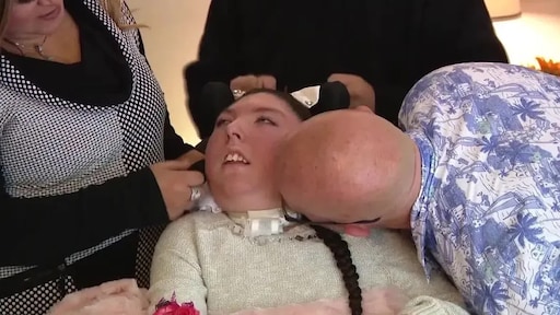 Vrouw zonder hersenen die maar 4 jaar zou worden, viert 20ste verjaardag