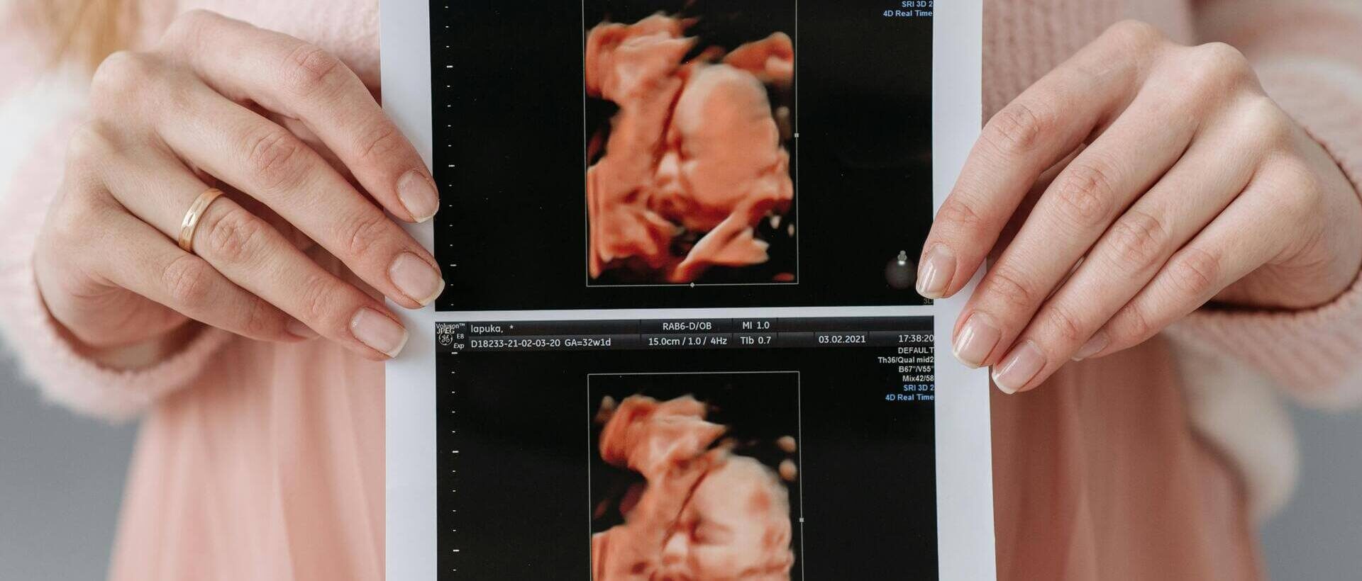 Commissie doet ontstellende ontdekking over onverdoofd aborteren, SGP wil debat