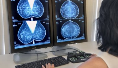 'Aanbieders promoten onbetrouwbaar borstonderzoek als kanker­screening'