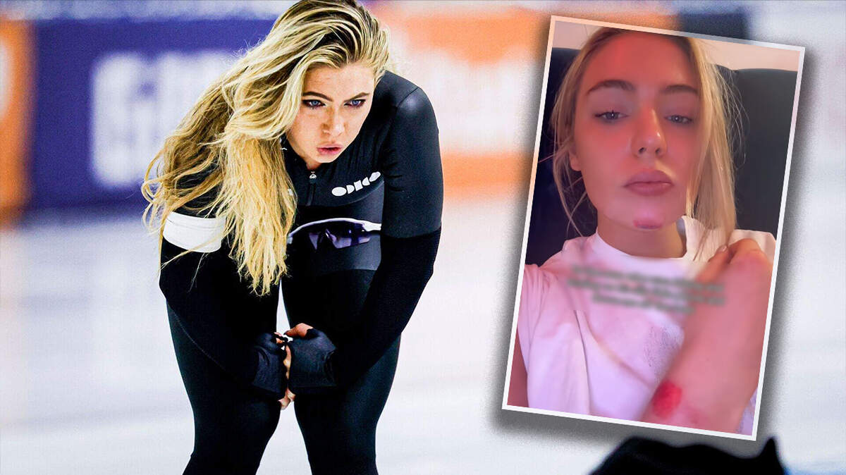 Jutta Leerdam liet via Tiktok weten dat zij is aangereden