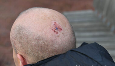 Ondernemer gemolesteerd door groep raddraaiers