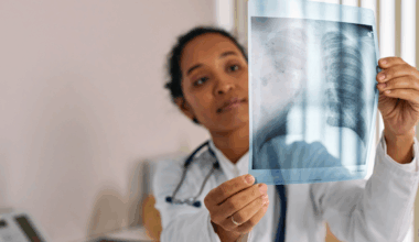 Longkanker bij niet-rokers komt steeds vaker voor: deze signalen mag je nooit negeren