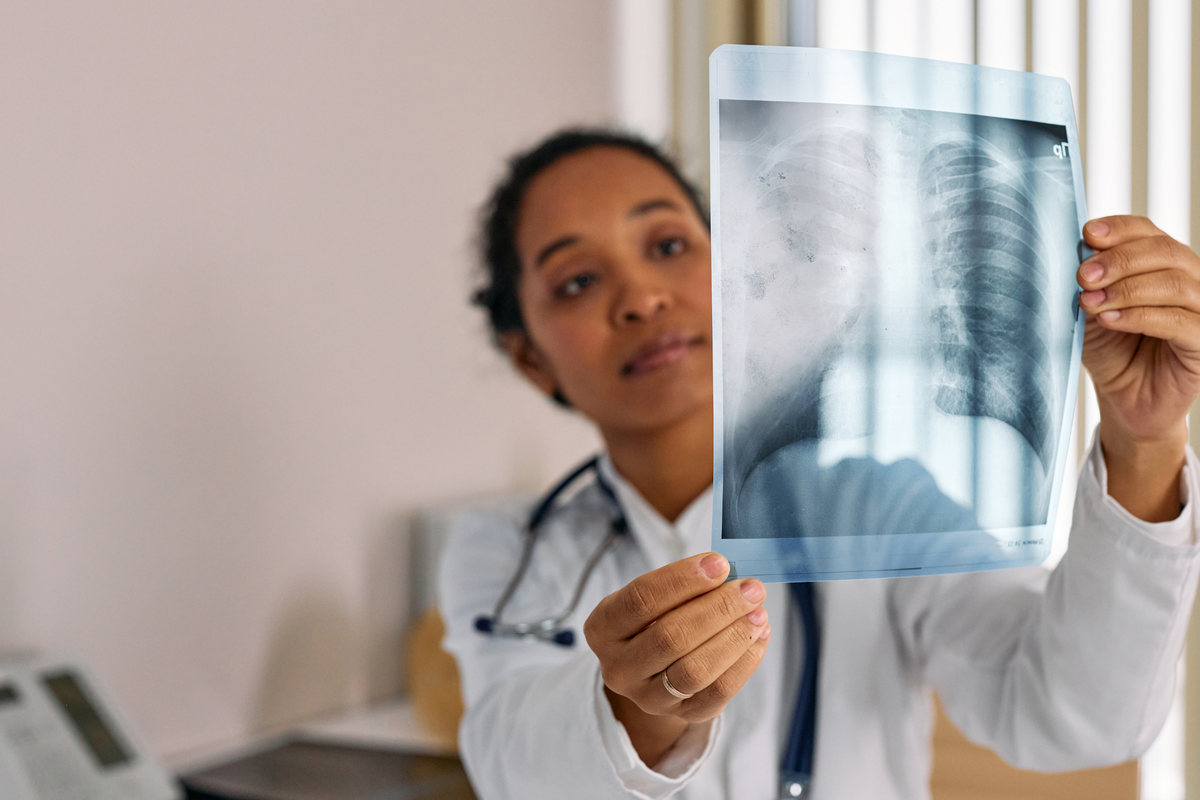 Longkanker bij niet-rokers komt steeds vaker voor: deze signalen mag je nooit negeren