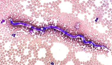 Arts haalt 11 centimeter lange worm uit ooglid Roemeense vrouw