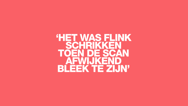 Wim over zijn diagnose alzheimer en optie tot euthanasie