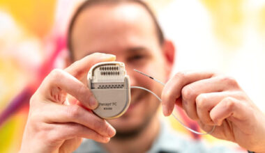 Diepe hersenstimulatie veilig en haalbaar bij ernstige tinnitus