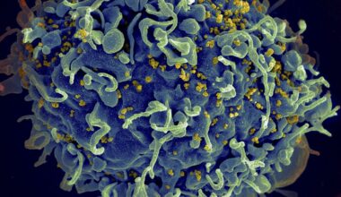 Zevende genezing van hiv met stamcellen geeft hints voor betere medicijnen