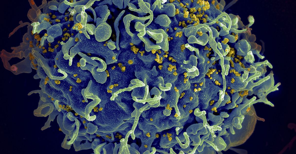 Zevende genezing van hiv met stamcellen geeft hints voor betere medicijnen
