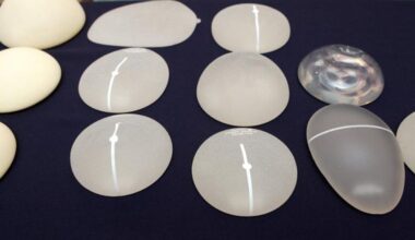 Geen schadevergoeding voor 60.000 vrouwen in borstimplantatenzaak