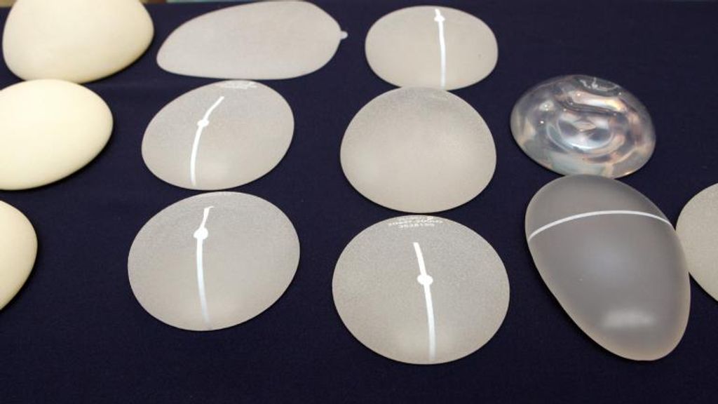 Geen schadevergoeding voor 60.000 vrouwen in borstimplantatenzaak