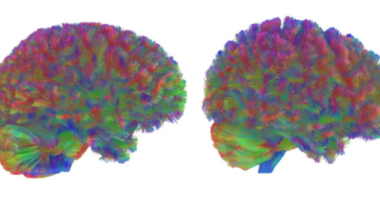 Welingelichte Kringen - Nieuws van overal: minder lezen, meer weten