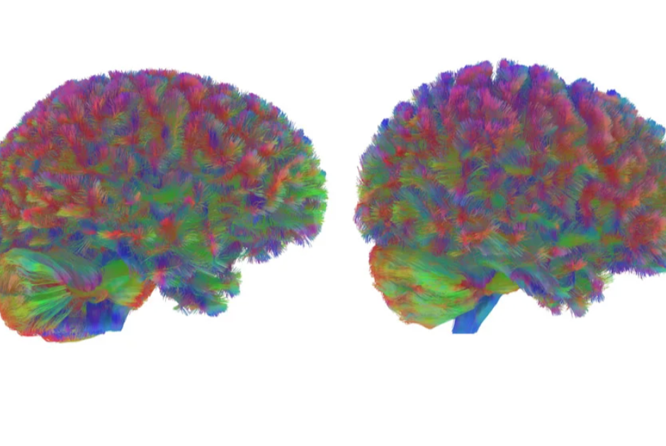 Welingelichte Kringen - Nieuws van overal: minder lezen, meer weten