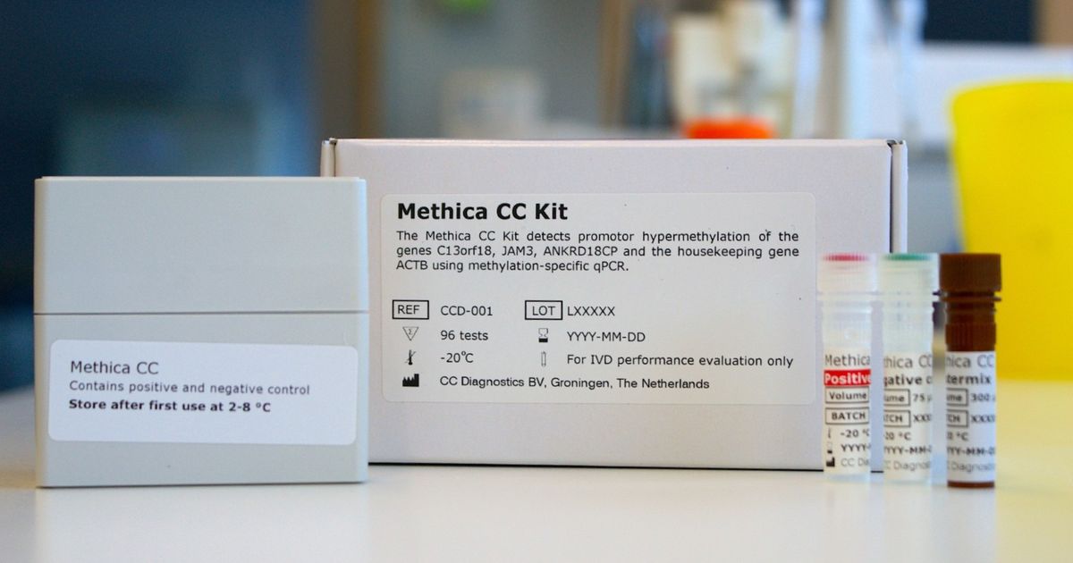 Nieuwe Groningse test voorkomt duizenden fouten bij opsporen baarmoederhalskanker