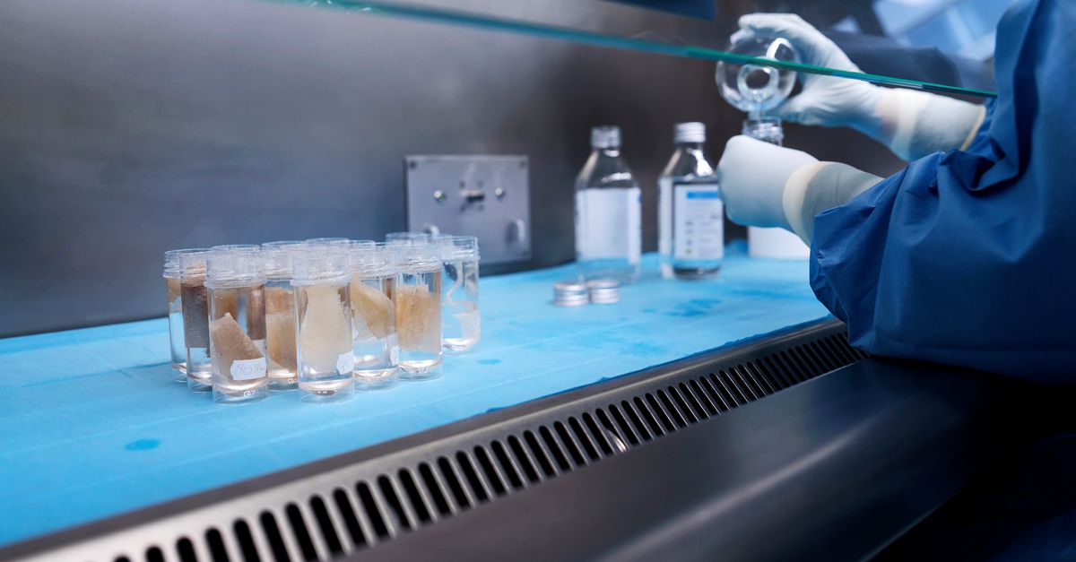 Nederlandse donorhuid helpt brandslachtoffers Crans-Montana: 123.000 cm² geleverd