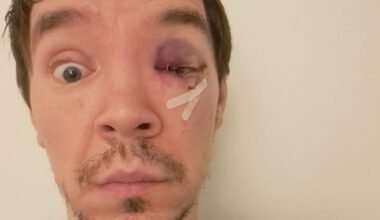 Man (41) opgepakt voor mishandeling cabaretier op Centraal Station