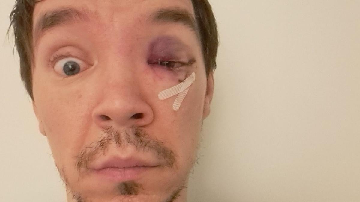 Man (41) opgepakt voor mishandeling cabaretier op Centraal Station