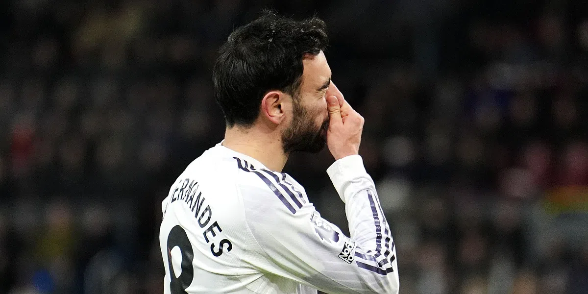 Manchester United speelt met 2-2 gelijk bij Burnley