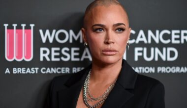 Teddi Mellencamp om kreftdiagnosen: - Ordene mine er litt stammende