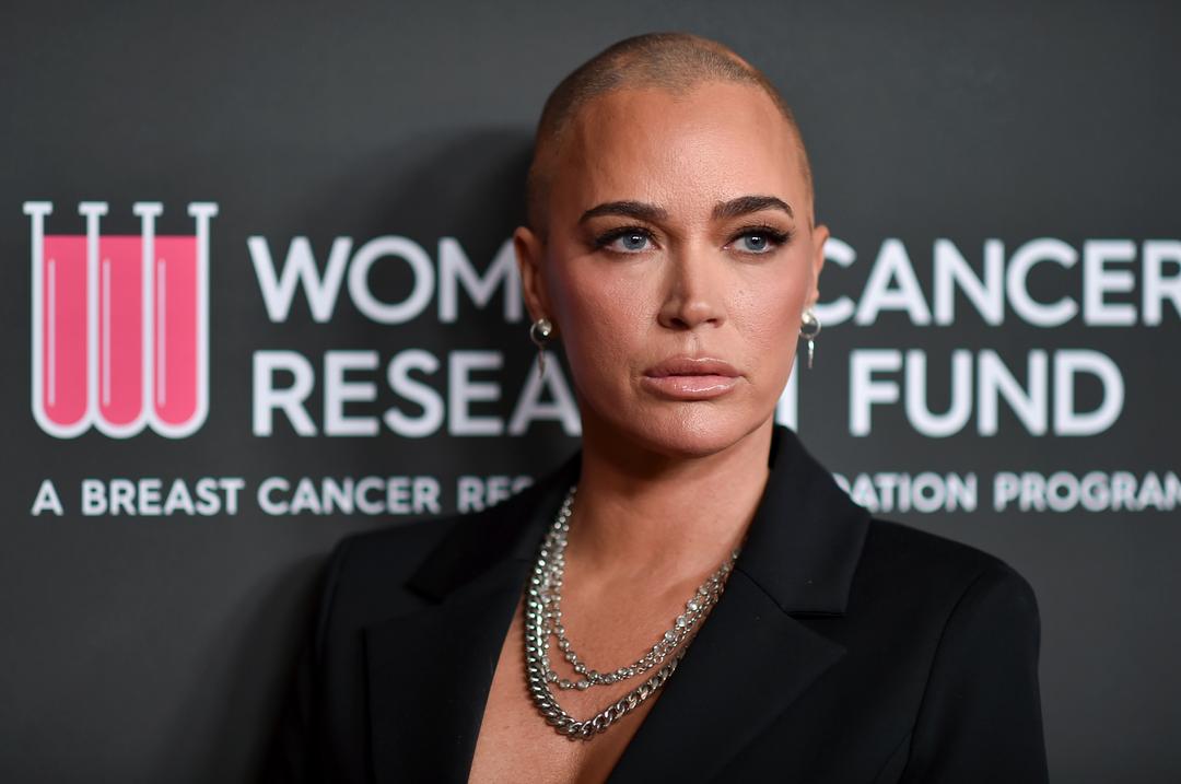 Teddi Mellencamp om kreftdiagnosen: - Ordene mine er litt stammende