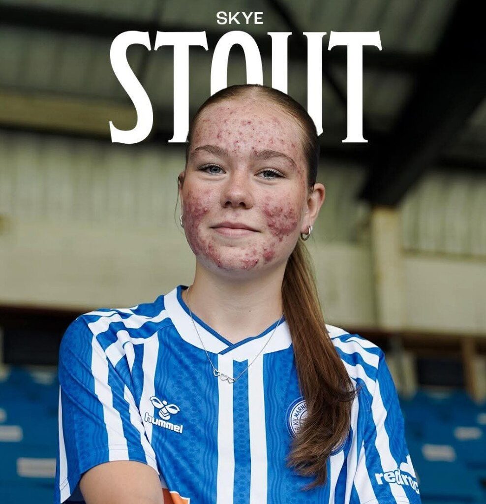 Fotball, Netthets | Klubben tvunget til å slette bildet: Nå får hun massiv støtte