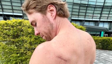Skulderskaden plager Aaleksander Amodt Kilde fortsatt: – Frustrerende