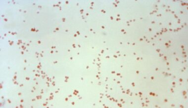 KI designet to nye antibiotika mot gonoré og MRSA