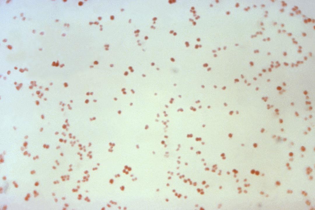 KI designet to nye antibiotika mot gonoré og MRSA