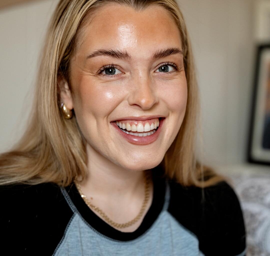 NÆRE: «Det er viktig å vise at vårt søskenforhold kan være både varmt, morsomt og krevende», skriver Selene Lie.  Foto: Privat
