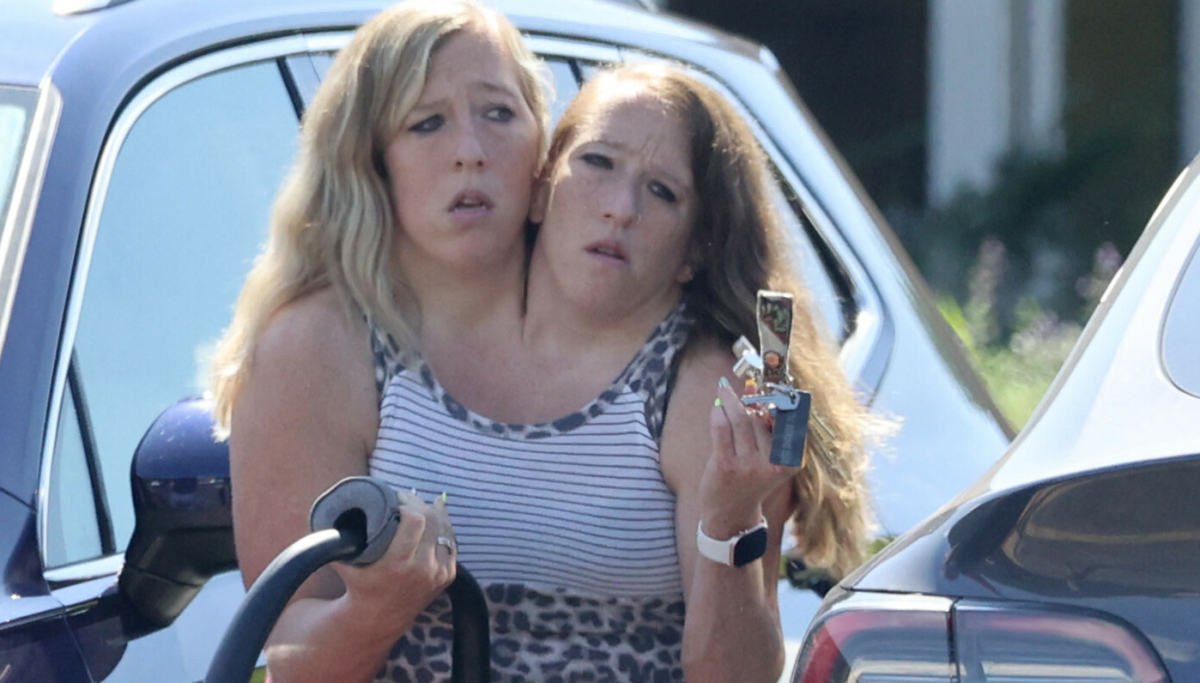 Siamesiske tvillinger Abby og Brittany Hensel: Har de blitt mødre?