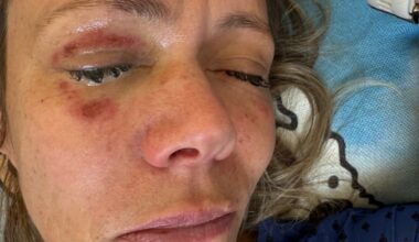 Mia (50) advarer etter dette: